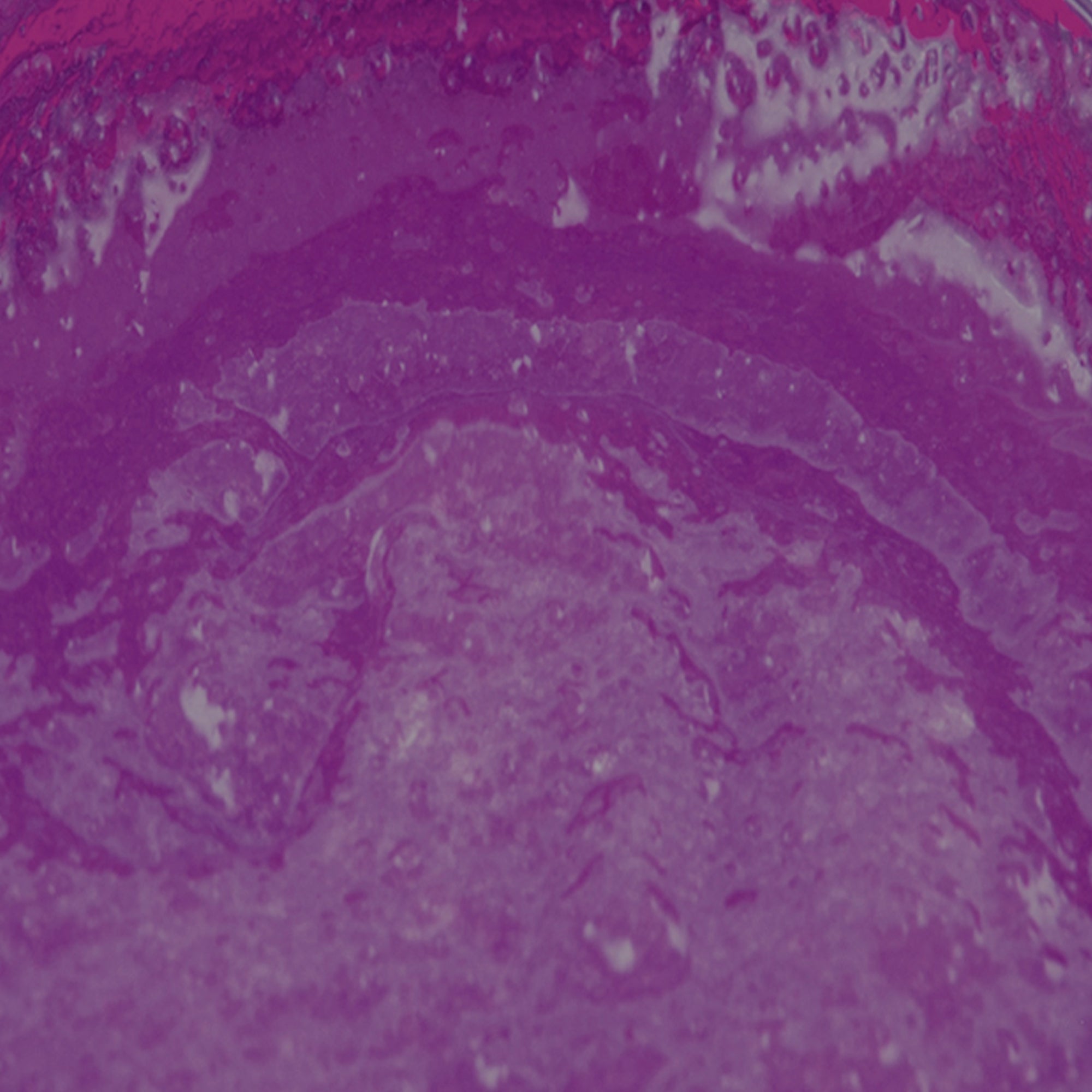 Coconut Oil Sugar Scrub - Berry